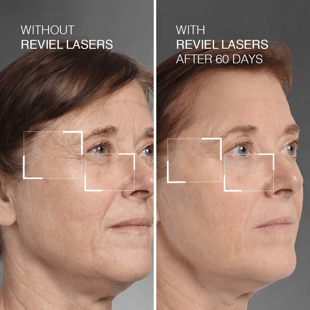 Reviel Eye Massager